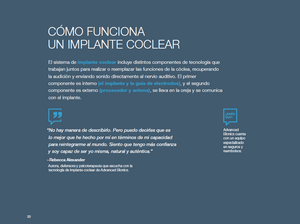 AB Cochlear Implant Candidate Guidebook - Spanish