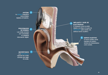 AB Cochlear Implant Candidate Guidebook - Spanish